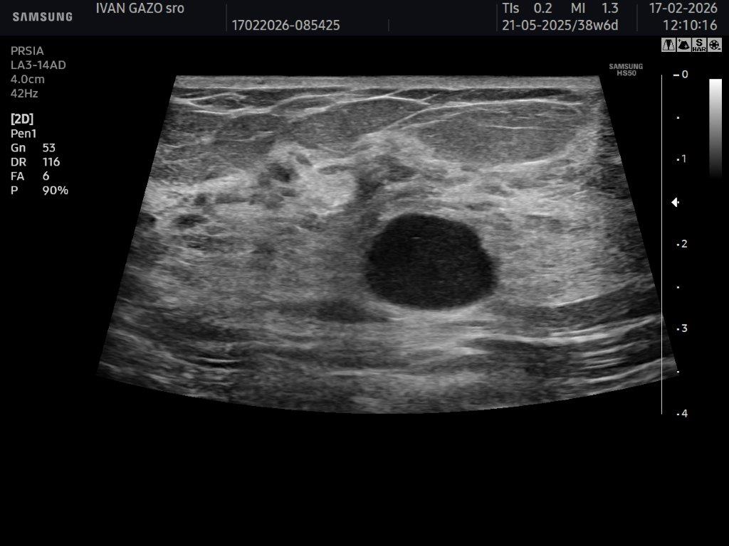 Mamológia - starostlivosť o prsníky