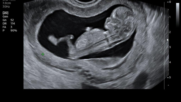 Starostlivosť o tehotné