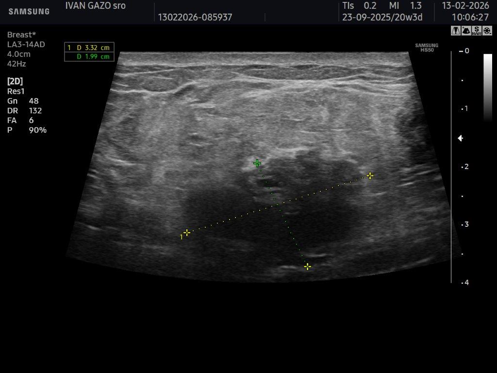 Mamológia - starostlivosť o prsníky