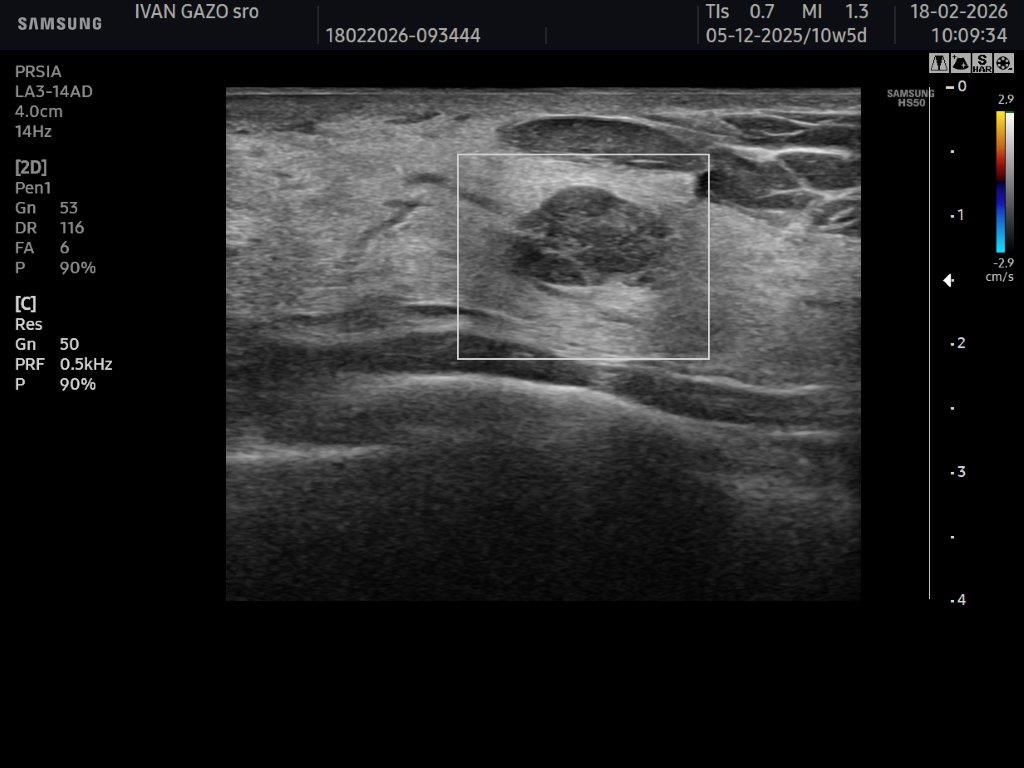 Mamológia - starostlivosť o prsníky